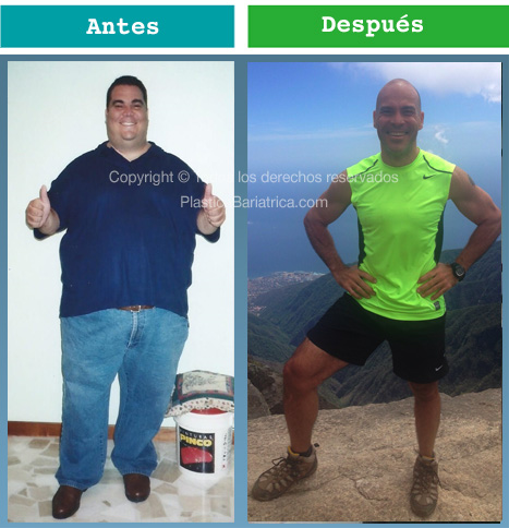 Base Pre y Post BRICK